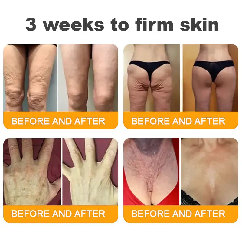 LOVILDS™ Bee Poison Skin Restoration Cream 👨⚕️