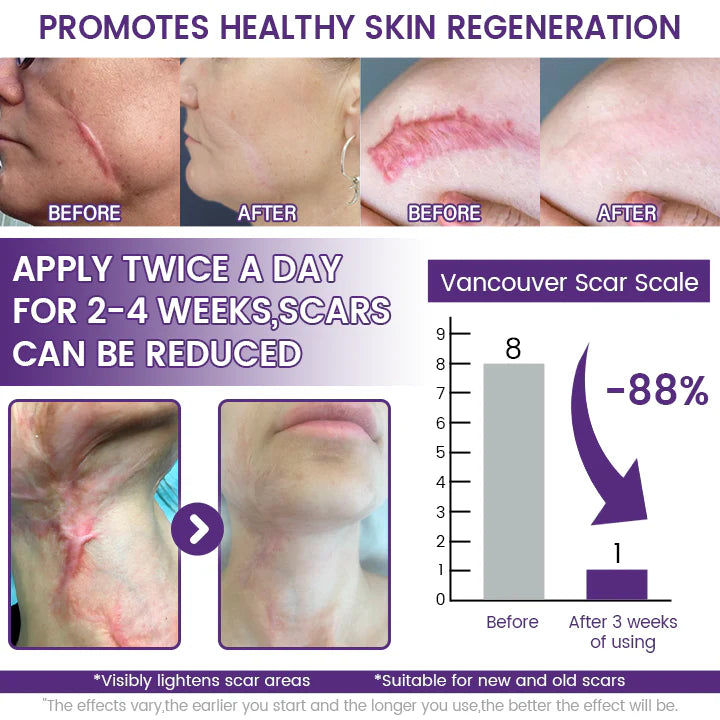 ReGenScar Stem Cell Scar Gel