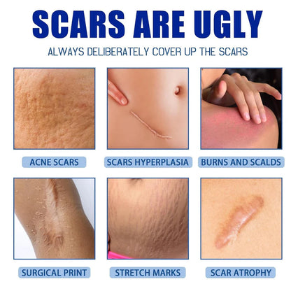 🩹 Alcuras Medical Grade Silicone Scar Cream – Smooth Scars Fast!