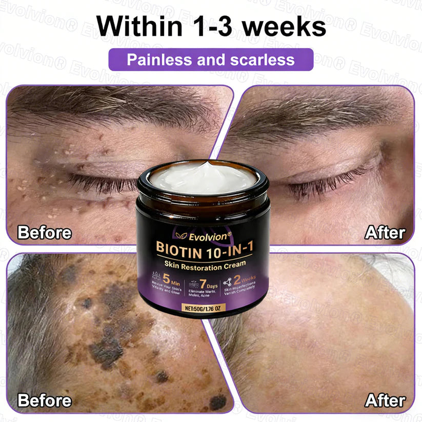 Limited-time offer: 70% off ⬇️Elivessa™ Biotin 10-in-1 Skin Restoration Cream