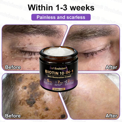 Limited-time offer: 70% off ⬇️Elivessa™ Biotin 10-in-1 Skin Restoration Cream