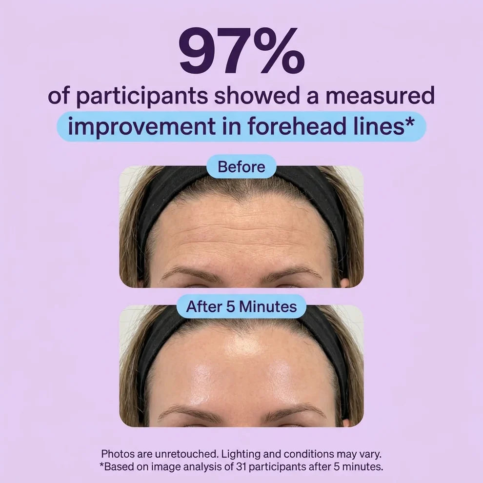 🔥Final 2 Hour 76% OFF🔥Eye Bag Instant Eraser, Tightens, Firms, & Blurs Wrinkles