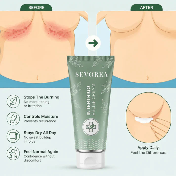 💚 LAST DAY BUY 1 GET 1 FREE✨Intertrigo Relief Cream treats 99% of skin fold rashes from the first application SevoreaTMIntertrigo Cream🛒