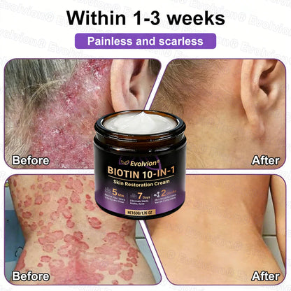 Limited-time offer: 70% off ⬇️Elivessa™ Biotin 10-in-1 Skin Restoration Cream