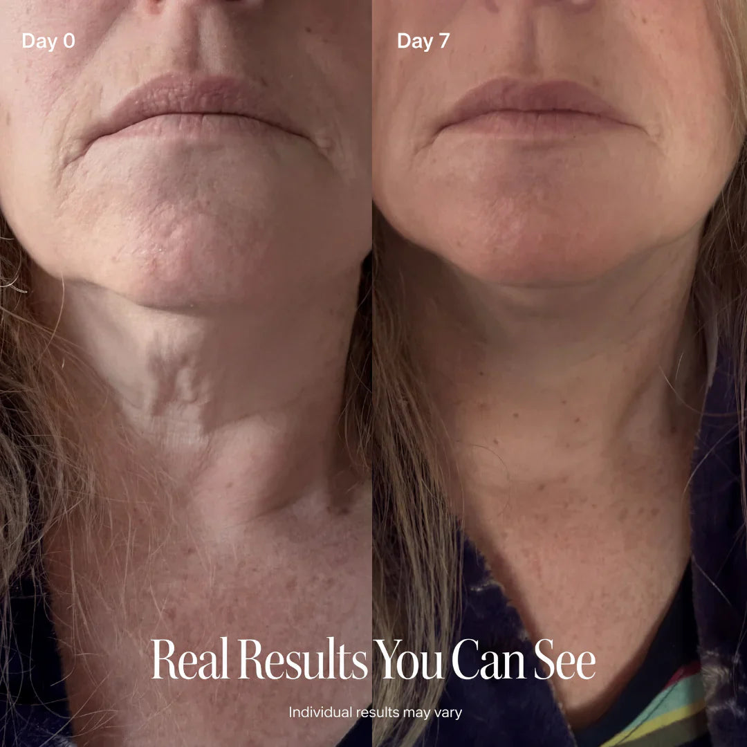 PEPTIDE Face Slimming Cream