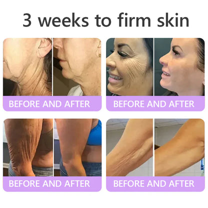 FDA Official: HISKIN PDRN Multi-Peptide Massaging Body RollerCream- Anti-aging, Hydrating, Skin Firming & Lifting, Skin Repair, Even Tone, Acne and Dark Spot Treatment, Wart and Mole Removal, and Psoriasis Relief.