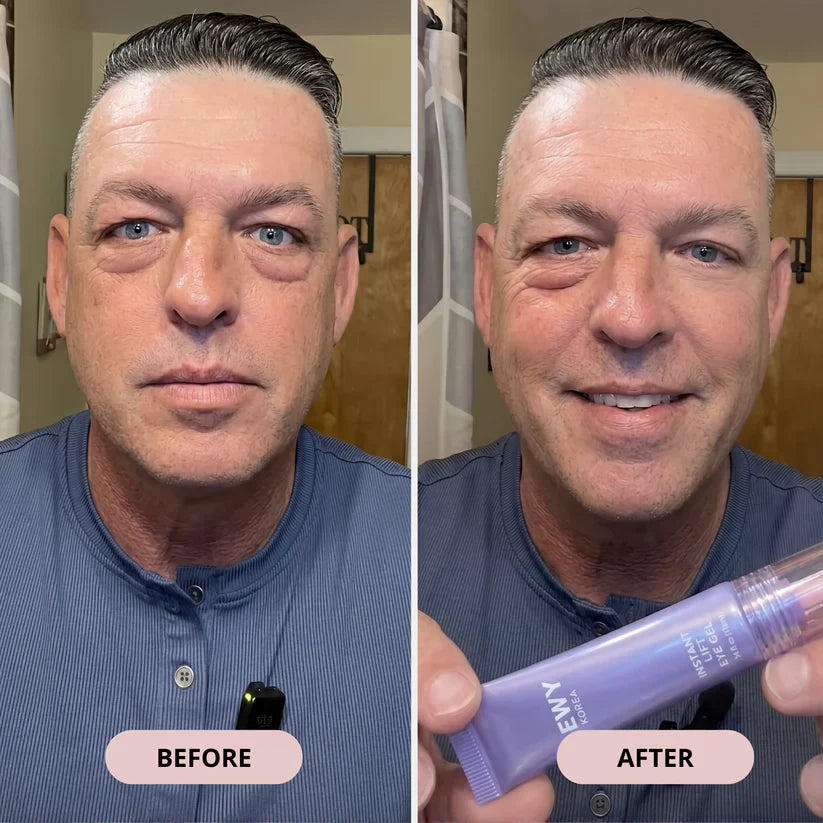 🔥Final 2 Hour 76% OFF🔥Eye Bag Instant Eraser, Tightens, Firms, & Blurs Wrinkles