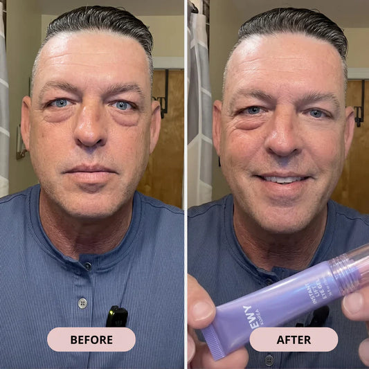 🔥Final 2 Hour 76% OFF🔥Eye Bag Instant Eraser, Tightens, Firms, & Blurs Wrinkles