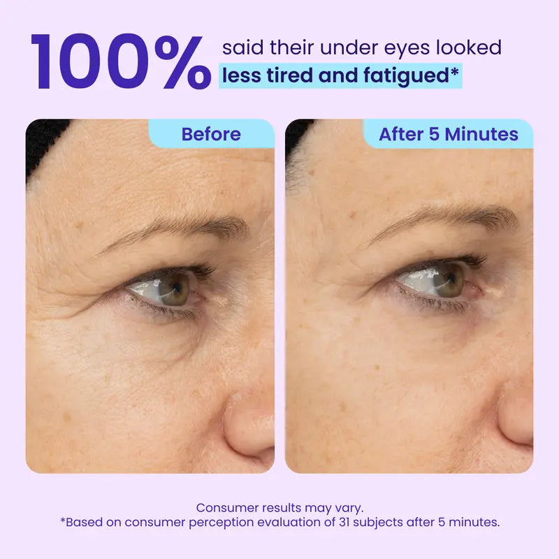 Final 3 Hours: 60%OFFInstant Lift Eye Gel forPuffiness, Bags & DarkCircles