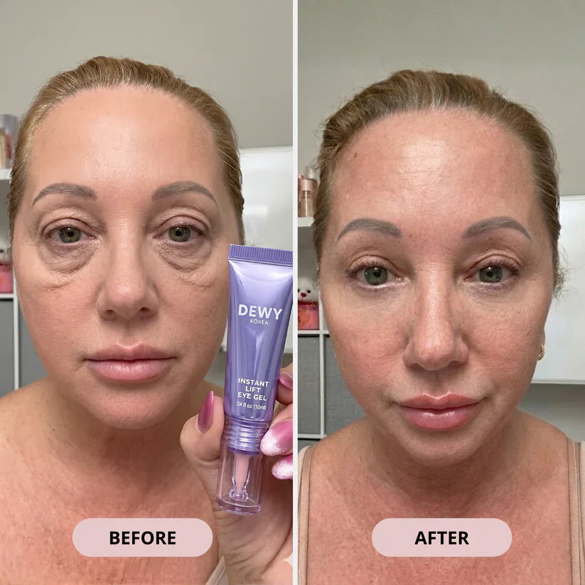 🔥Final 2 Hour 76% OFF🔥Eye Bag Instant Eraser, Tightens, Firms, & Blurs Wrinkles