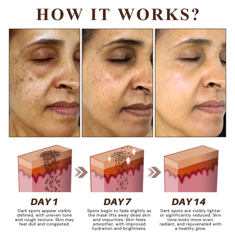 🔥🔥🔥Herbal Spots PeelOff Facial Mask