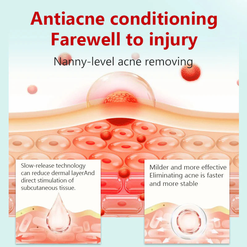 SERYNTHTM ACNE TREATMENTADAPALENE GEL