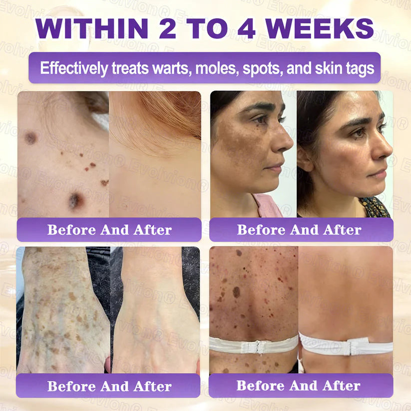 Limited-time offer: 70% off ⬇️Elivessa™ Biotin 10-in-1 Skin Restoration Cream