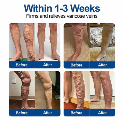 Moon Rind® VeinTarget Microneedle Patch