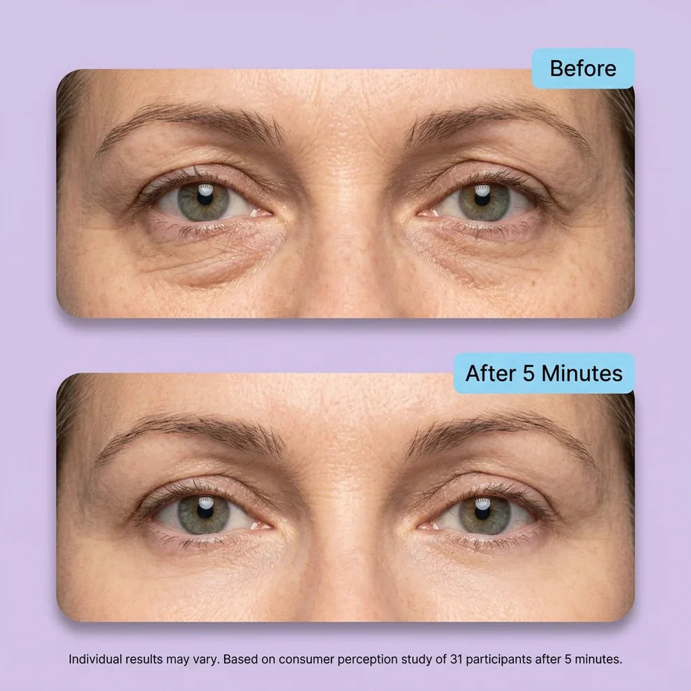 🔥Final 2 Hour 76% OFF🔥Eye Bag Instant Eraser, Tightens, Firms, & Blurs Wrinkles