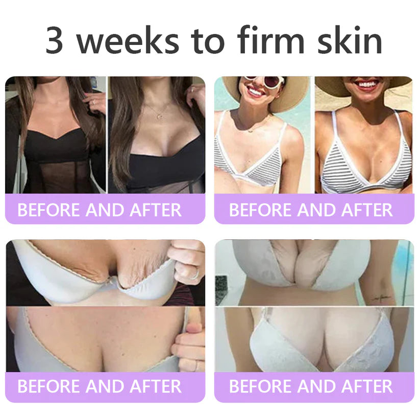 FDA Official: HISKIN PDRN Multi-Peptide Massaging Body RollerCream- Anti-aging, Hydrating, Skin Firming & Lifting, Skin Repair, Even Tone, Acne and Dark Spot Treatment, Wart and Mole Removal, and Psoriasis Relief.