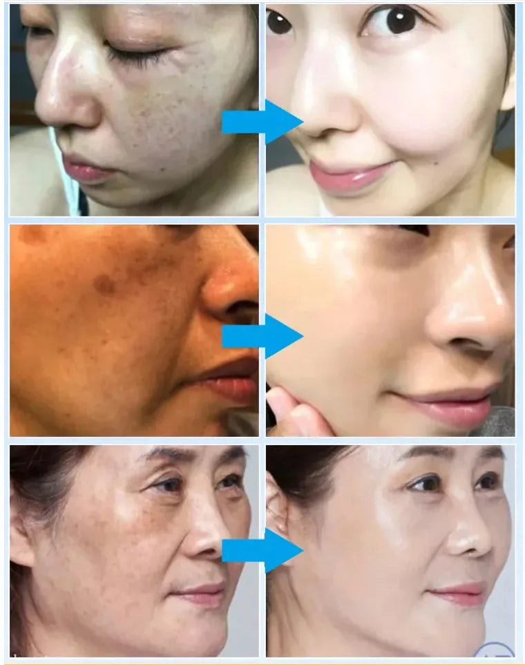 5X Pro-XylaneAnti Aging Mouizturizing Cream