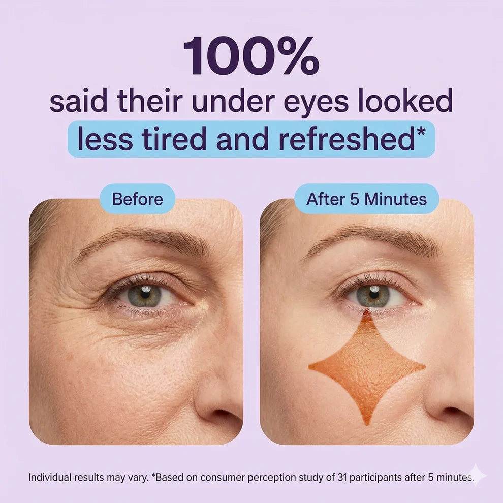 🔥Final 2 Hour 76% OFF🔥Eye Bag Instant Eraser, Tightens, Firms, & Blurs Wrinkles
