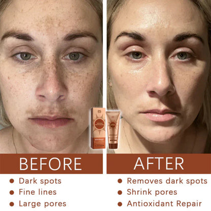 🔥🔥🔥Herbal Spots PeelOff Facial Mask